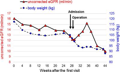 Successful therapeutic strategy for a patient with obese end-stage kidney disease by simultaneous laparoscopic sleeve gastrectomy and implantation of a buried peritoneal dialysis catheter: A case report